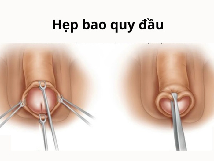 Điểm Danh Top Bệnh Nam Khoa Nguy Hiểm Thường Gặp