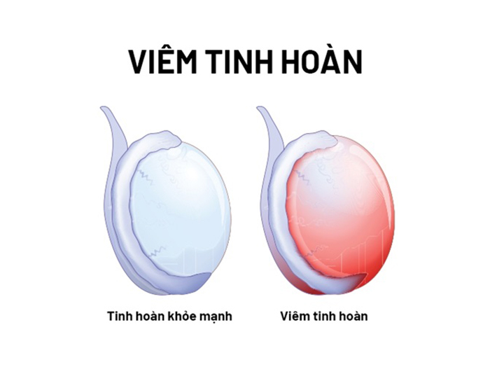 Điểm Danh Top Bệnh Nam Khoa Nguy Hiểm Thường Gặp