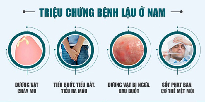 Nam Giới Cùng Những Bệnh Da Liễu Phổ Biến Thường Gặp