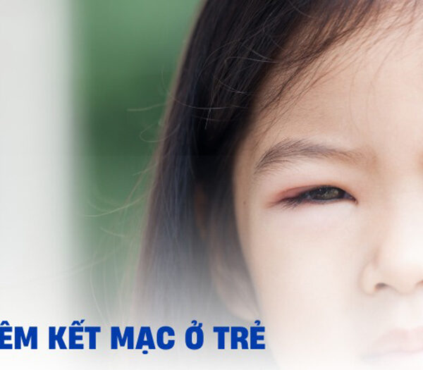 Tổng Hợp Các Bệnh Lý Thường Gặp Về Mắt Của Trẻ Nhỏ