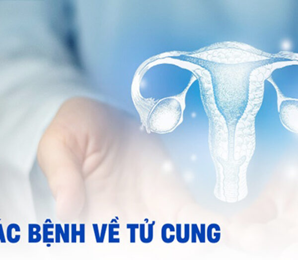Top Bệnh Tử Cung Nguy Hiểm Thường Gặp Ở Nữ Giới