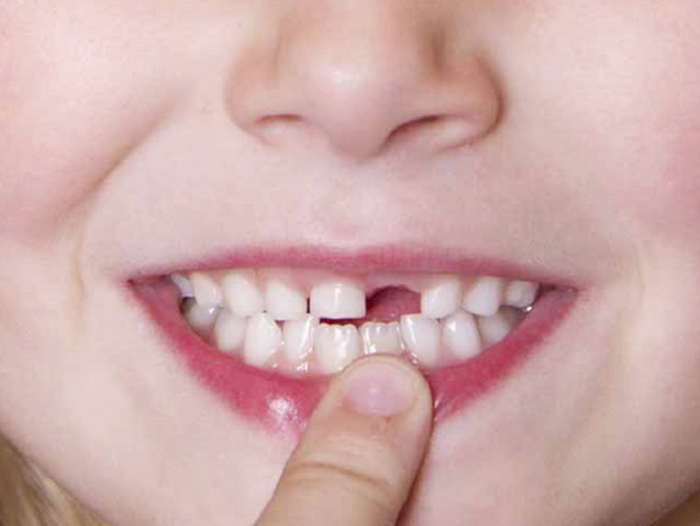 Bạn có biết con mọc răng khi nào? Thứ tự mọc răng ra sao?