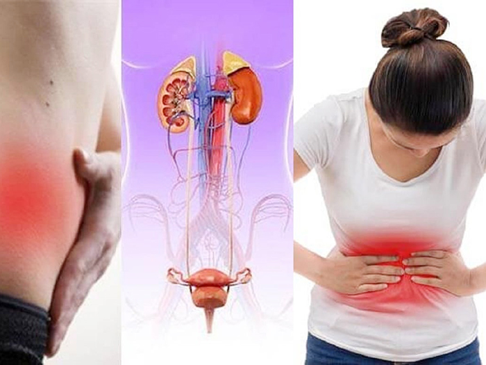 Nữ giới đi tiểu buốt - Dấu hiệu sức khỏe không thể chủ quan