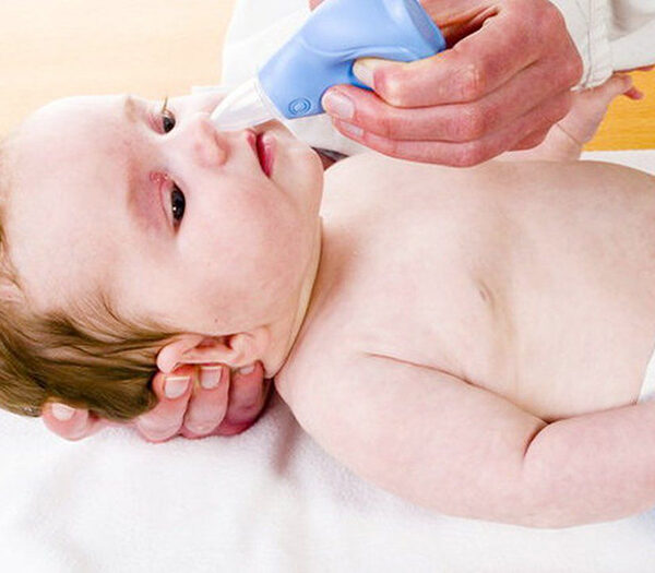 Nghẹt mũi ở trẻ sơ sinh - Nguyên nhân và mách Mẹ cách xử trí