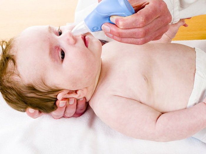 Nghẹt mũi ở trẻ sơ sinh - Nguyên nhân và mách Mẹ cách xử trí