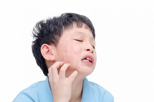 Tìm hiểu về bệnh quai bị? Những ảnh hưởng của bệnh đến nam giới khi bị.