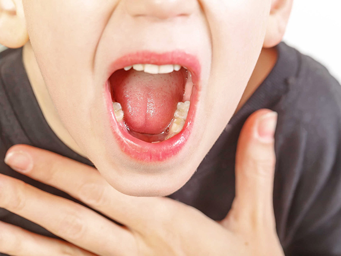 Viêm họng cấp ở trẻ em. Nguyên nhân và cách điều trị an toàn