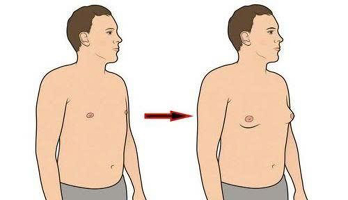Cách nhận biết tăng nội tiết tố nữ và cách điều trị hiệu quả